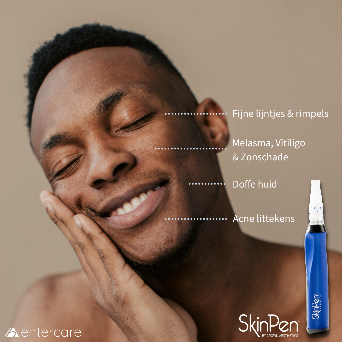 microneedling_skinpen_barendrecht